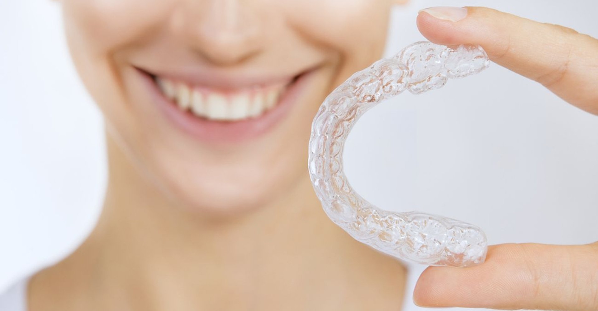 Orthodontiste à Marly Dr Lisa Perret-Bocahut invisalign